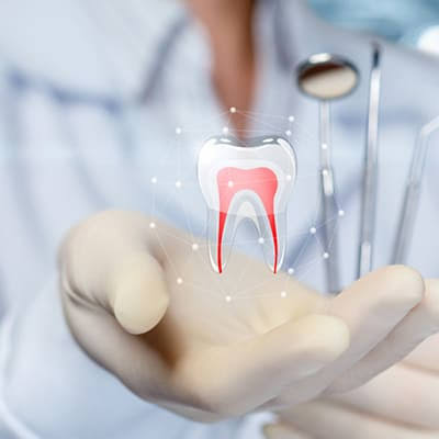 Replacement of Missing Teeth